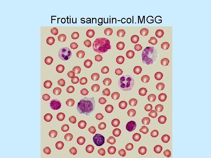 Frotiu sanguin-col. MGG Frotiu sanguin-col. MGG