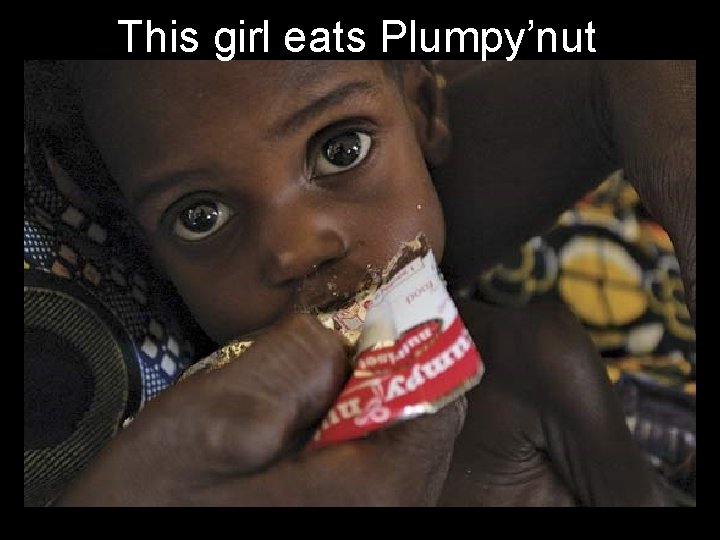 This girl eats Plumpy’nut 