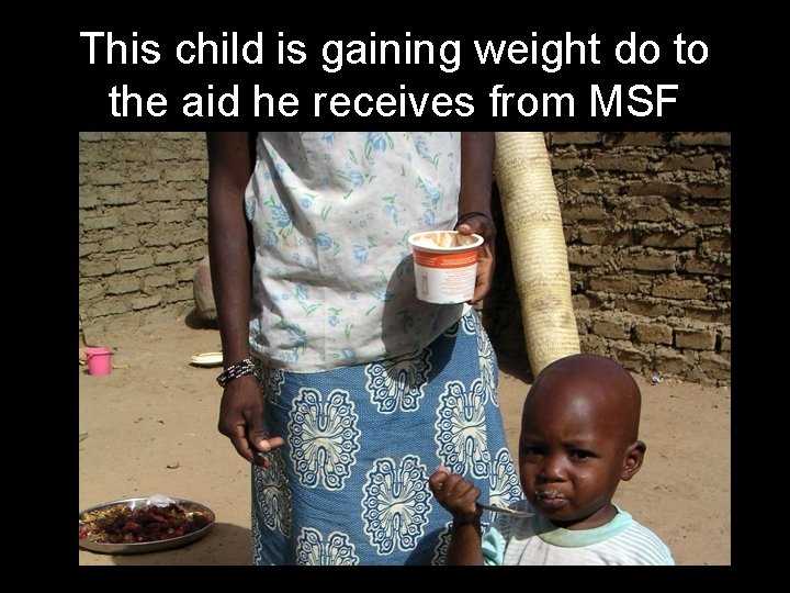 This child is gaining weight do to the aid he receives from MSF 