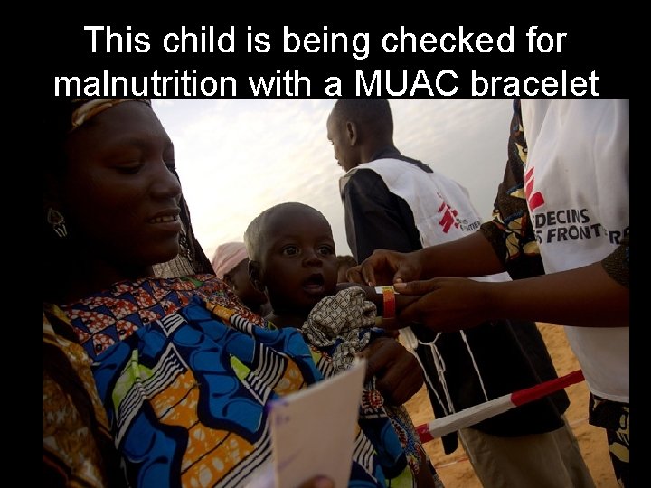 This child is being checked for malnutrition with a MUAC bracelet 