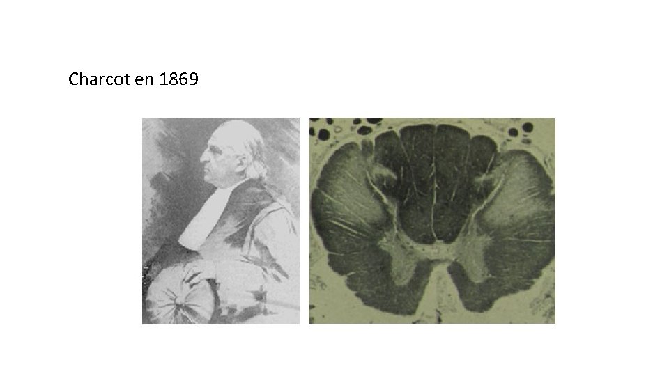 Charcot en 1869 