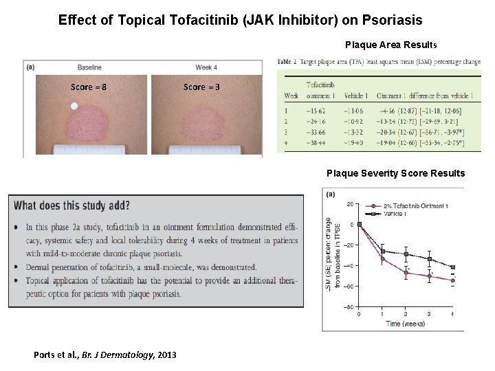 Effect of Topical Tofacitinib (JAK Inhibitor) on Psoriasis Plaque Area Results Score = 8