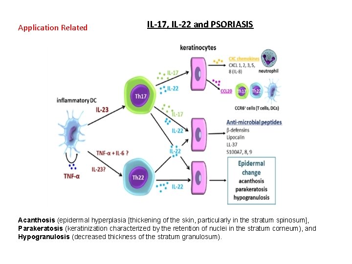 Application Related IL-17, IL-22 and PSORIASIS Acanthosis (epidermal hyperplasia [thickening of the skin, particularly