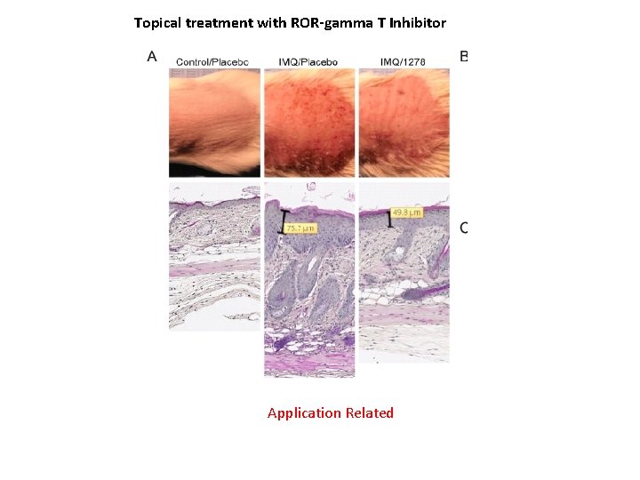 Topical treatment with ROR-gamma T Inhibitor Application Related 