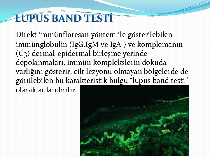 LUPUS BAND TESTİ Direkt immünfloresan yöntem ile gösterilebilen immünglobulin (Ig. G, Ig. M ve