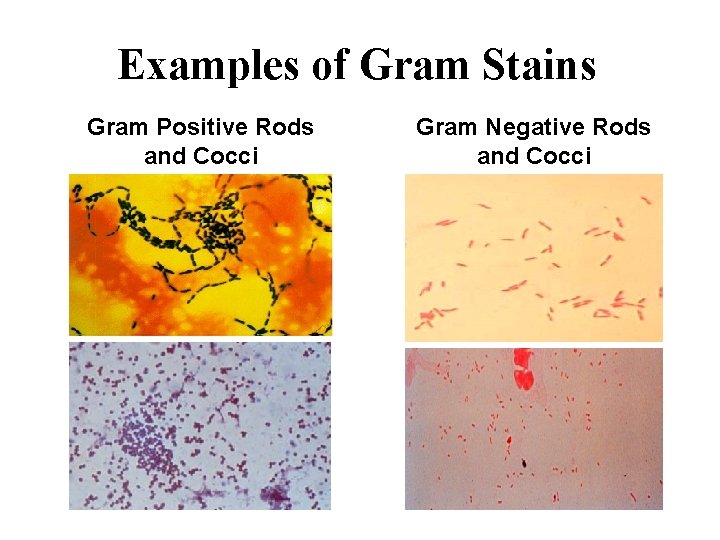 Examples of Gram Stains Gram Positive Rods and Cocci Gram Negative Rods and Cocci