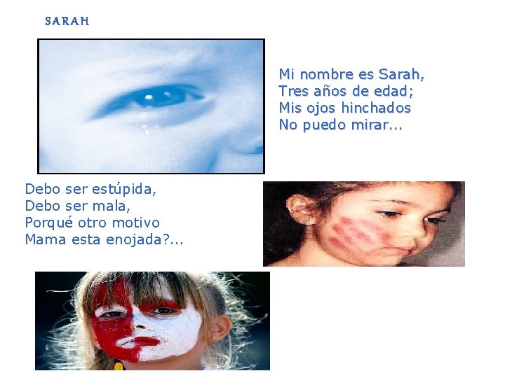 SARAH Mi nombre es Sarah, Tres años de edad; Mis ojos hinchados No puedo