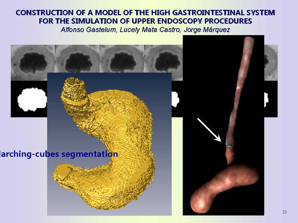 CONSTRUCTION OF A MODEL OF THE HIGH GASTROINTESTINAL SYSTEM FOR THE SIMULATION OF UPPER