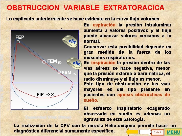 . OBSTRUCCION VARIABLE EXTRATORACICA Lo explicado anteriormente se hace evidente en la curva flujo