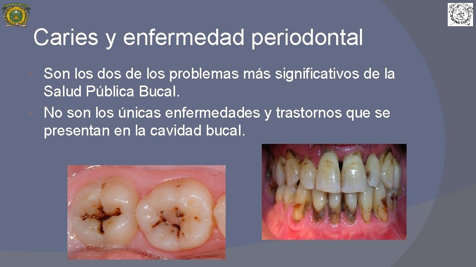 Caries y enfermedad periodontal Son los de los problemas más significativos de la Salud