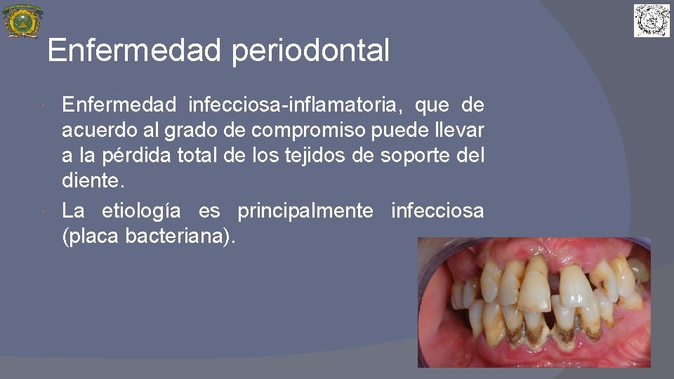 Enfermedad periodontal Enfermedad infecciosa-inflamatoria, que de acuerdo al grado de compromiso puede llevar a