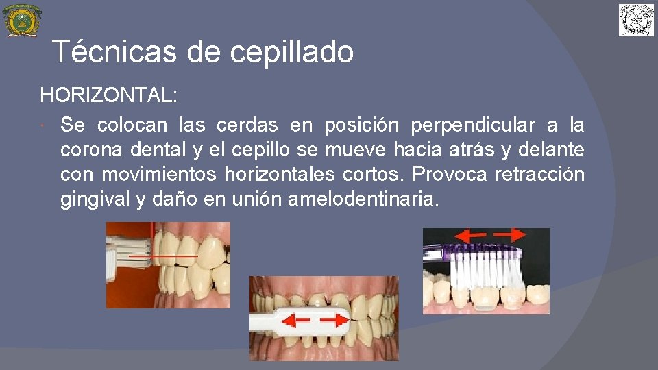 Técnicas de cepillado HORIZONTAL: Se colocan las cerdas en posición perpendicular a la corona