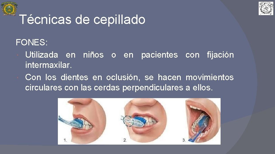 Técnicas de cepillado FONES: Utilizada en niños o en pacientes con fijación intermaxilar. Con
