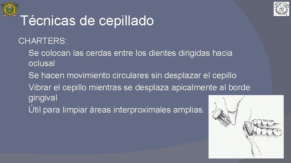 Técnicas de cepillado CHARTERS: Se colocan las cerdas entre los dientes dirigidas hacia oclusal