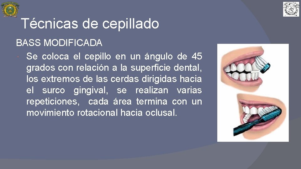 Técnicas de cepillado BASS MODIFICADA Se coloca el cepillo en un ángulo de 45