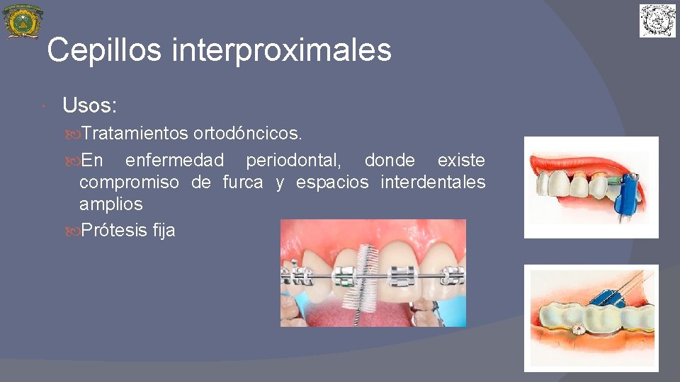 Cepillos interproximales Usos: Tratamientos ortodóncicos. En enfermedad periodontal, donde existe compromiso de furca y