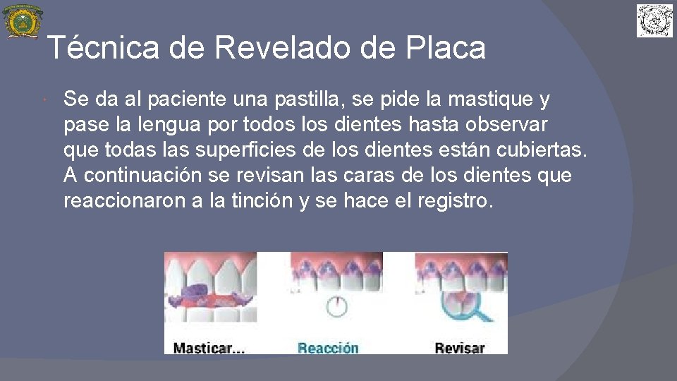 Técnica de Revelado de Placa Se da al paciente una pastilla, se pide la