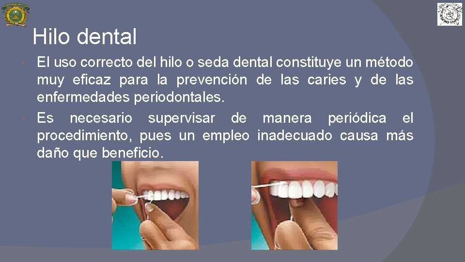 Hilo dental El uso correcto del hilo o seda dental constituye un método muy