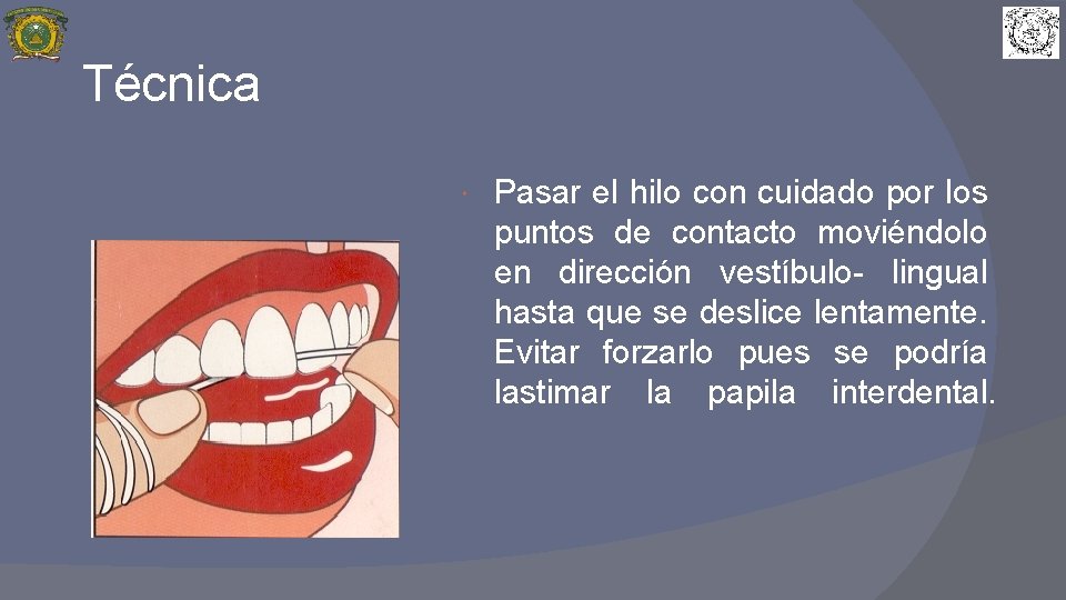 Técnica Pasar el hilo con cuidado por los puntos de contacto moviéndolo en dirección