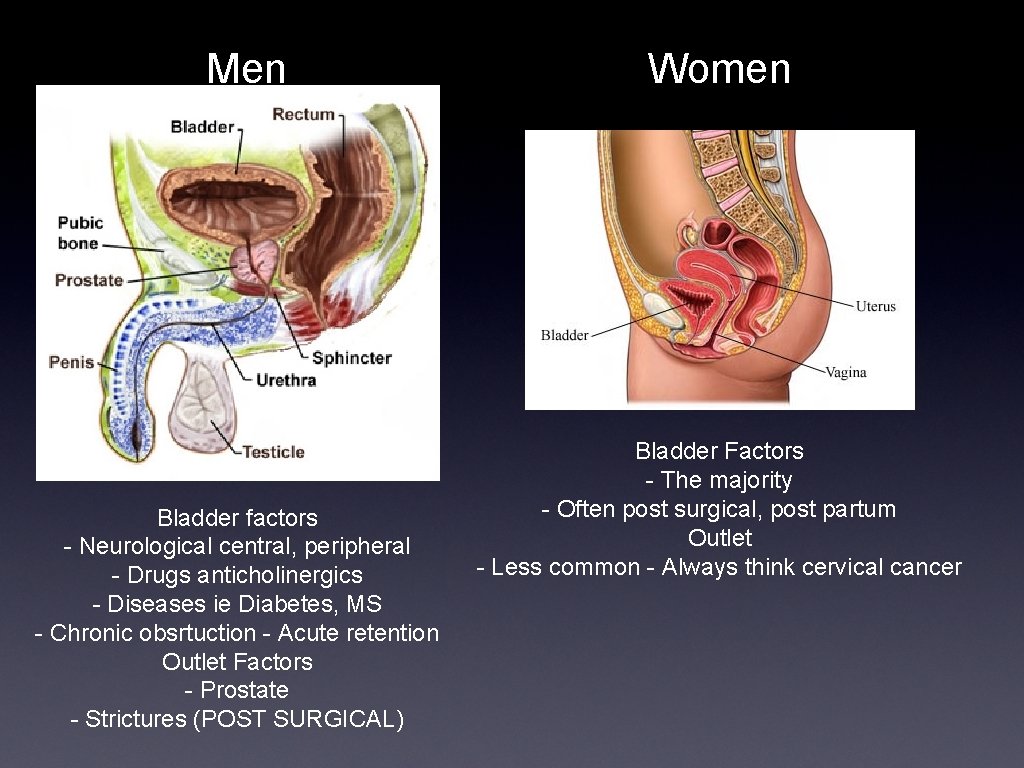 Men Bladder factors - Neurological central, peripheral - Drugs anticholinergics - Diseases ie Diabetes,