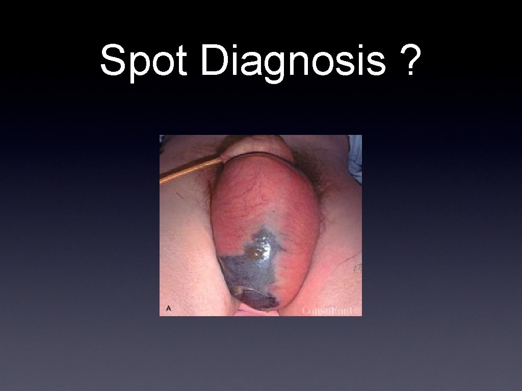 Spot Diagnosis ? 