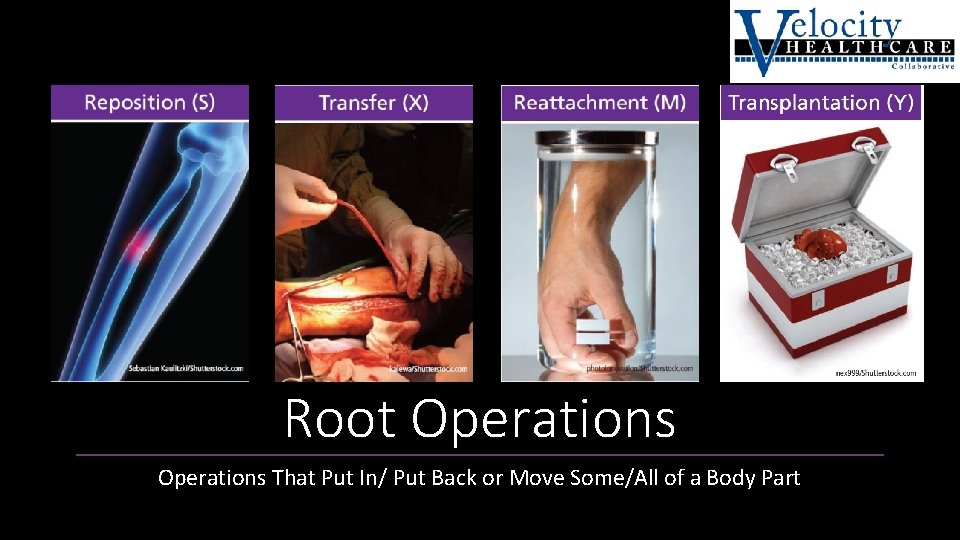 Root Operations That Put In/ Put Back or Move Some/All of a Body Part