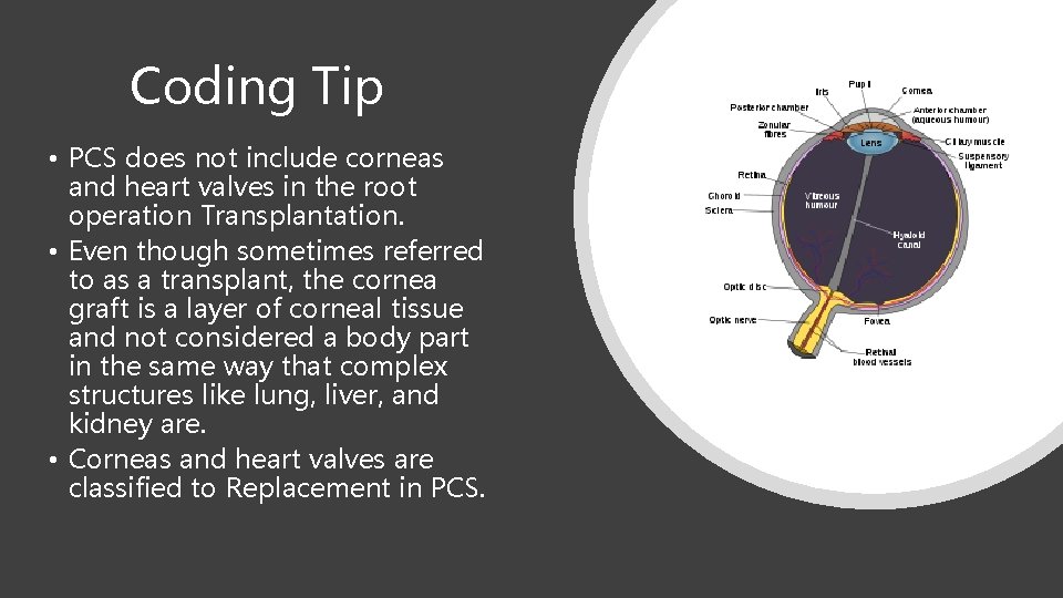 Coding Tip • PCS does not include corneas and heart valves in the root