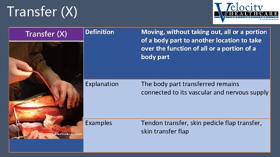 Transfer (X) Transfer X Definition Moving, without taking out, all or a portion of