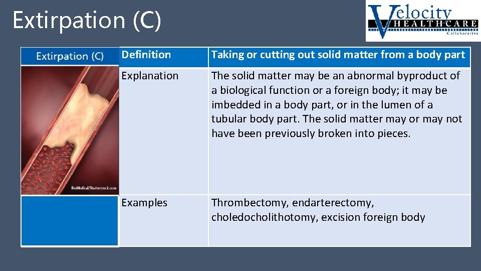 Extirpation (C) Extirpation C Definition Taking or cutting out solid matter from a body