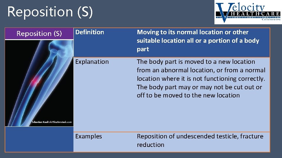 Reposition (S) Reposition S Definition Moving to its normal location or other suitable location