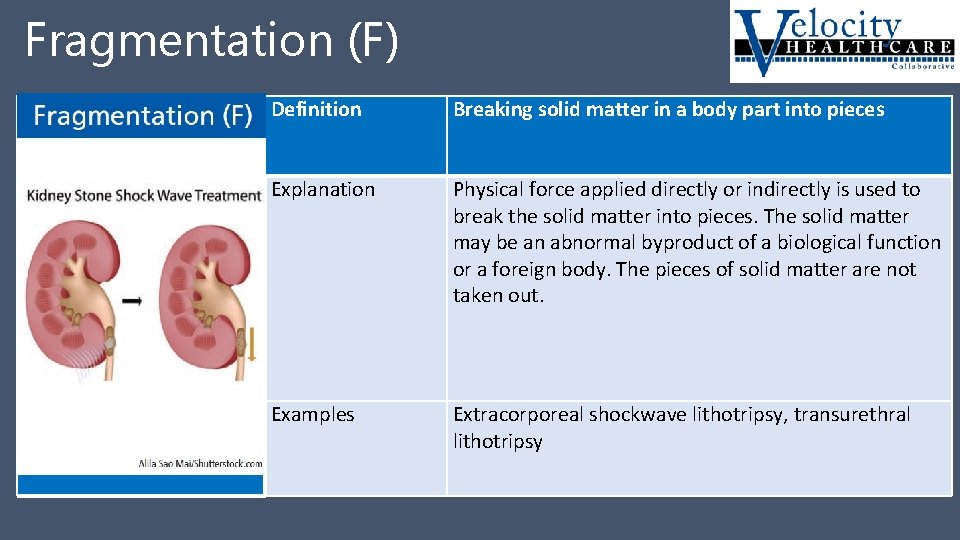 Fragmentation (F) Fragmentation F Definition Breaking solid matter in a body part into pieces