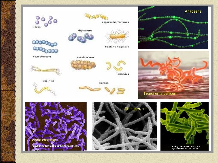 Anabaena Treponema pallidum Streptomyces Vibrio cholerae 