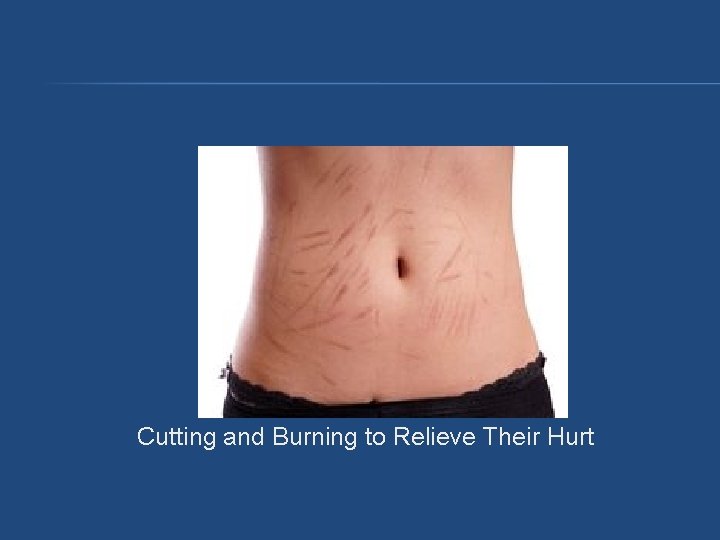 Cutting and Burning to Relieve Their Hurt Cutting and Burning to Relieve Their Hurt