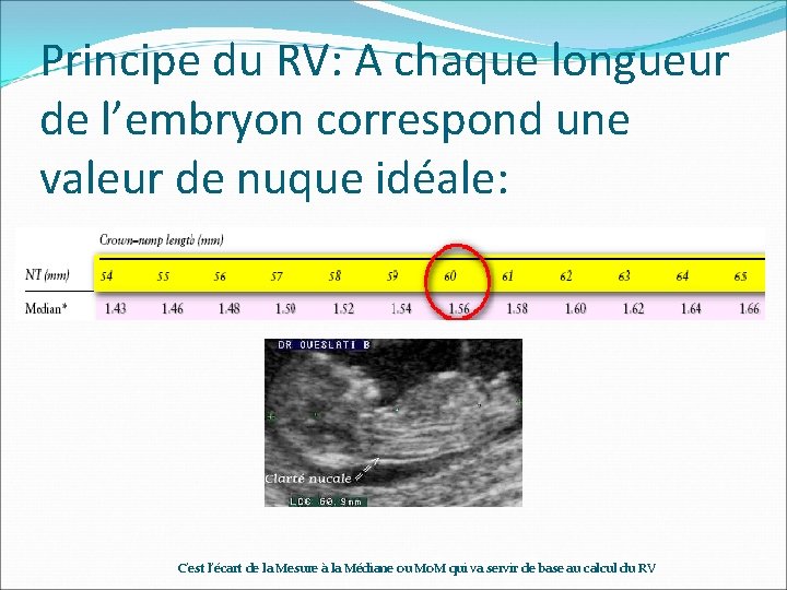 Principe du RV: A chaque longueur de l’embryon correspond une valeur de nuque idéale: Principe du RV: A chaque longueur de l’embryon correspond une valeur de nuque idéale: