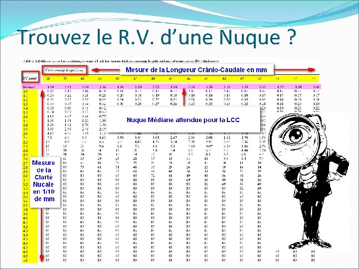 Trouvez le R. V. d’une Nuque ? Trouvez le R. V. d’une Nuque ?