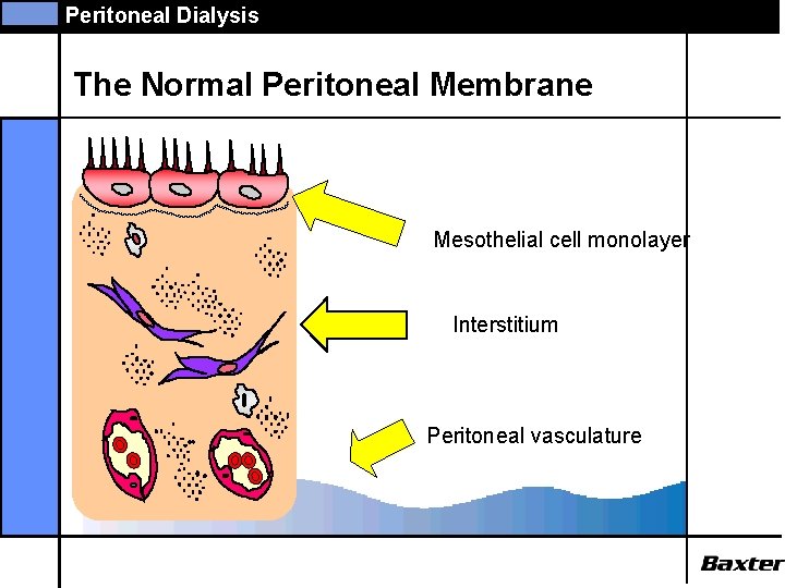 Peritoneal Dialysis The Normal Peritoneal Membrane Mesothelial cell monolayer Interstitium Peritoneal vasculature 