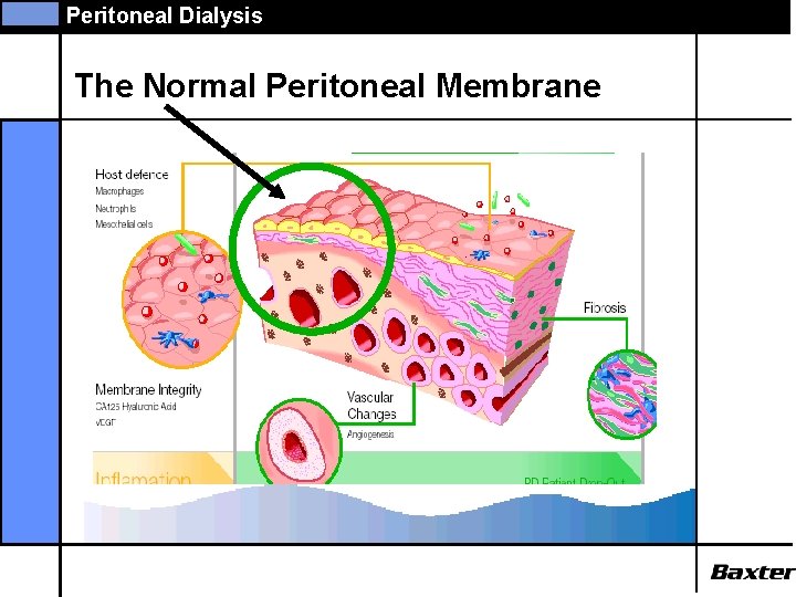 Peritoneal Dialysis The Normal Peritoneal Membrane 
