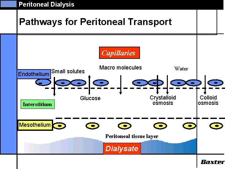 Peritoneal Dialysis Pathways for Peritoneal Transport Capillaries Endothelium Small solutes Interstitium Macro molecules Water
