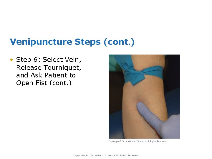 Venipuncture Steps (cont. ) • Step 6: Select Vein, Release Tourniquet, and Ask Patient