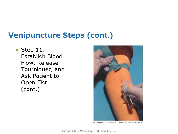 Venipuncture Steps (cont. ) • Step 11: Establish Blood Flow, Release Tourniquet, and Ask