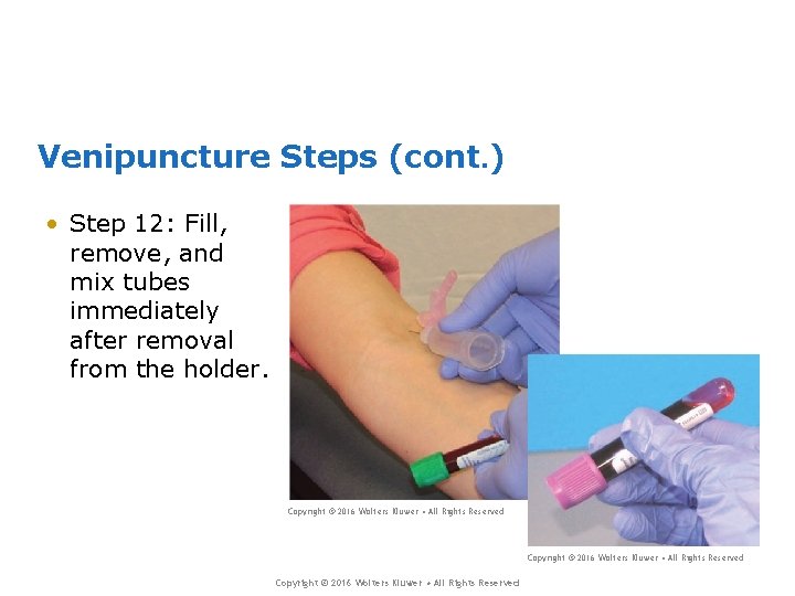 Venipuncture Steps (cont. ) • Step 12: Fill, remove, and mix tubes immediately after