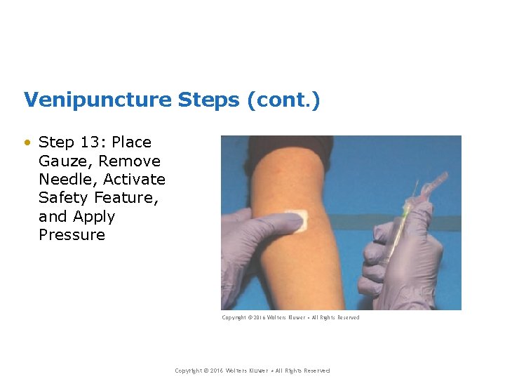 Venipuncture Steps (cont. ) • Step 13: Place Gauze, Remove Needle, Activate Safety Feature,