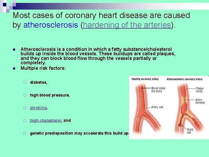 Most cases of coronary heart disease are caused by atherosclerosis (hardening of the arteries). Most cases of coronary heart disease are caused by atherosclerosis (hardening of the arteries).