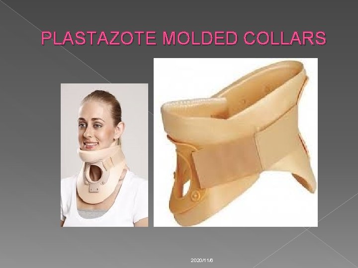 PLASTAZOTE MOLDED COLLARS 2020/11/6 