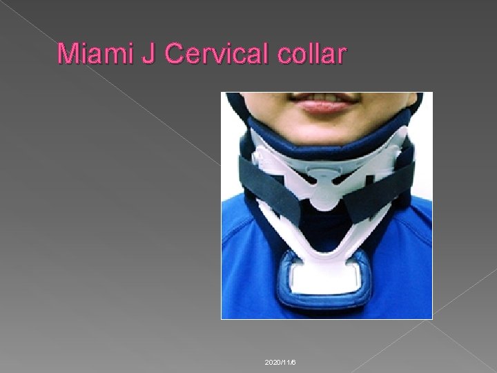 Miami J Cervical collar 2020/11/6 