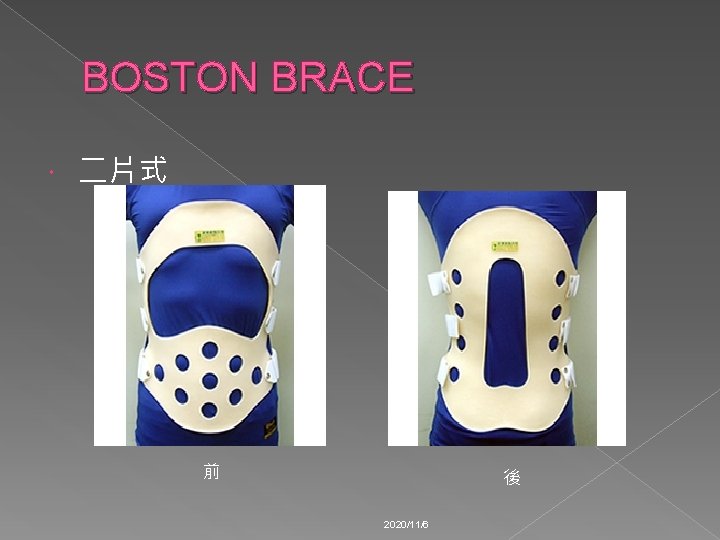 BOSTON BRACE 二片式 前 後 2020/11/6 