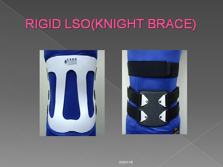 RIGID LSO(KNIGHT BRACE) 2020/11/6 