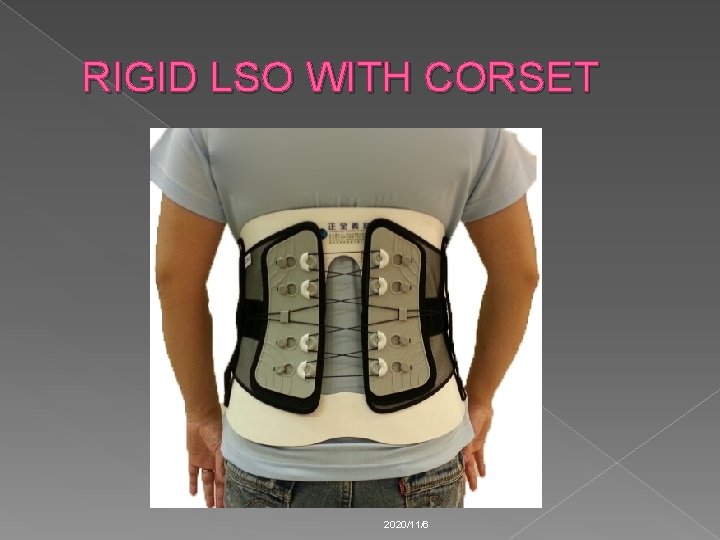 RIGID LSO WITH CORSET 2020/11/6 