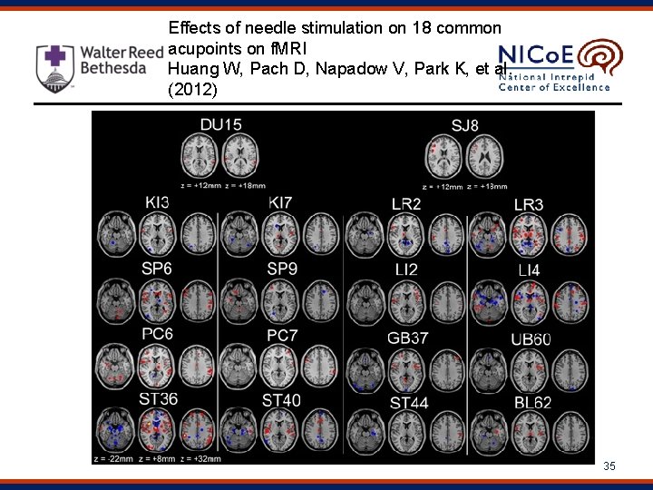 Effects of needle stimulation on 18 common acupoints on f. MRI Huang W, Pach