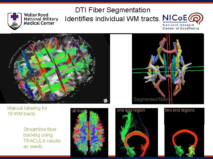 DTI Fiber Segmentation Identifies individual WM tracts. Segmented fibers Manual labeling for 18 WM